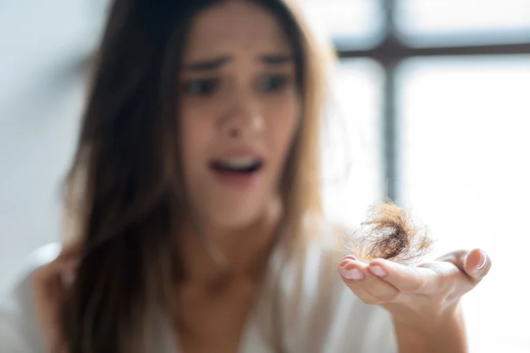 Symbolbild zum Thema Haarausfall: Eine Frau betrachtet erschrocken eine größere Menge ausgefallener Haare in ihrer Handfläche.